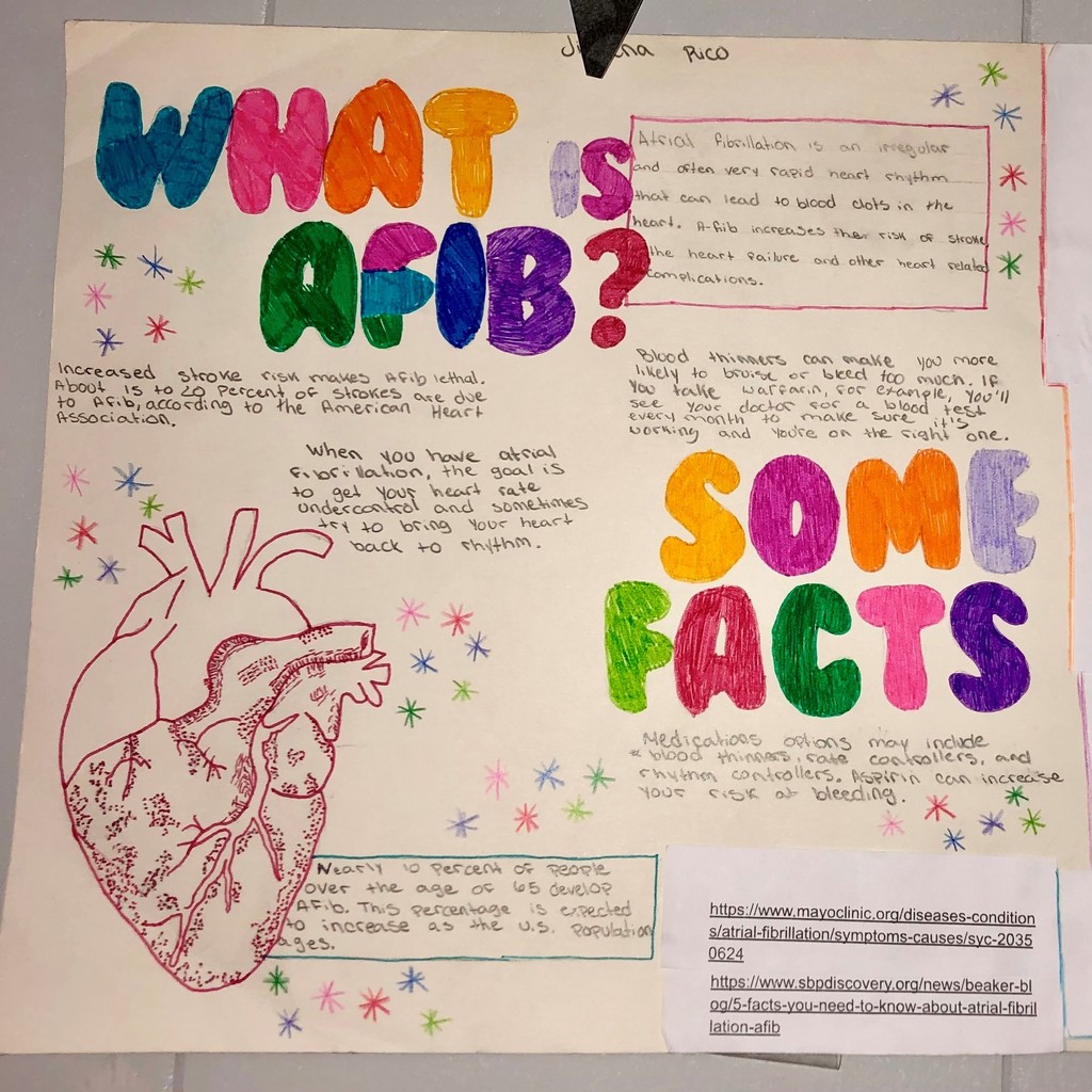 what is AFIB poster with facts listed.